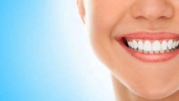 smile perfect teeth after braces