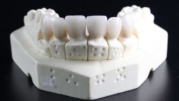 dental implants