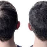 hair before after