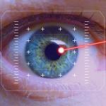 lasik eye surgery