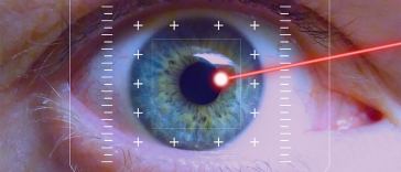 lasik eye surgery