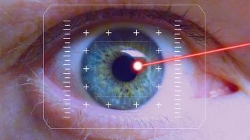 lasik eye surgery