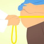 liposuction