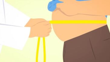 liposuction
